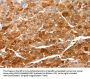 CIDEC Antibody