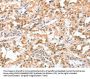 CIDEC Antibody