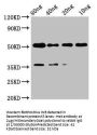 met Antibody