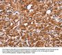SLC8A2 Antibody