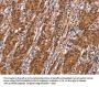 SLC8A2 Antibody