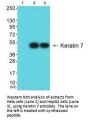 KRT7 Antibody