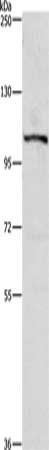 PTK2 Antibody