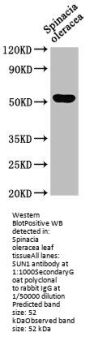 SUN1 Antibody