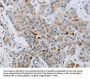 Rabbit anti-human CKMT1A/CKMT1B polyclonal antibody