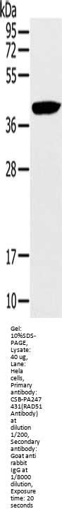 RAD51 Antibody