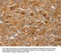 FTH1 Antibody