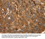 FTH1 Antibody