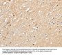 RRAD Antibody