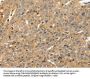RRAD Antibody