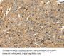 RRAD Antibody