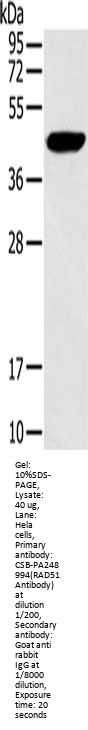 RAD51 Antibody