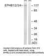 EPHB1/EPHB2/EPHB3/EPHB4 (Ab-600/602/614/596) Antibody