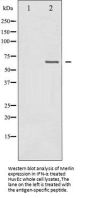 NF2 Antibody