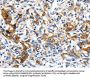 LRP1 Antibody