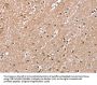 RAB8A Antibody