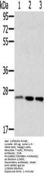 RAB8A Antibody
