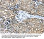 IFNA2 Antibody