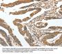 CKAP2 Antibody