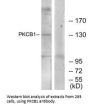 ZMYND8 Antibody