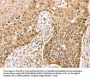 SMARCA2 Antibody