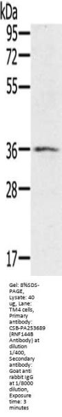 RNF144B Antibody