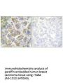 ITGB4 (Ab-1510) Antibody