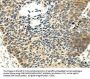 Rabbit anti-human MAP3K7 polyclonal antibody