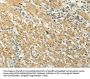 Rabbit anti-human MAP3K7 polyclonal antibody