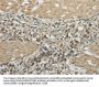 TRIB2 Antibody