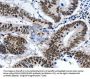 LRP5 Antibody