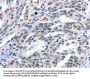 LRP5 Antibody