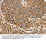 SCD Antibody