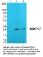 MMP7 Antibody