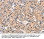 ARHGAP4 Antibody
