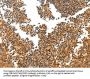 Rabbit anti-human TERT polyclonal antibody
