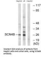 STMN1 Antibody