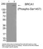 Phospho-BRCA1 (Ser1457) Antibody