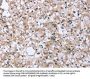 FCAR Antibody