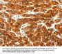 PLXNA3 Antibody