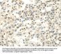 CDKN1A Antibody