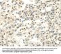 CDKN1A Antibody