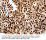 HDAC2 Antibody