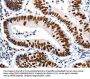 HDAC2 Antibody