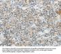 SCN9A Antibody
