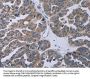 TP53AIP1 Antibody