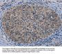 TP53AIP1 Antibody