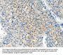 TPM2 Antibody