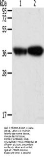 TPM2 Antibody