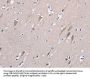 Rabbit anti-human STMN1 polyclonal antibody